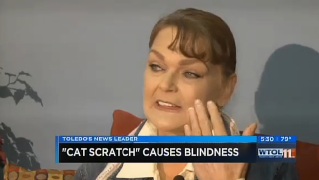 Woman goes blind after pet cat licks her