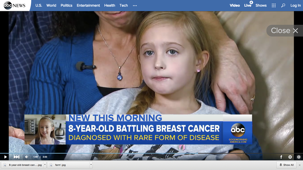 ABC News: 8 Year Old Girl Fighting Breast Cancer Getting a Mastectomy