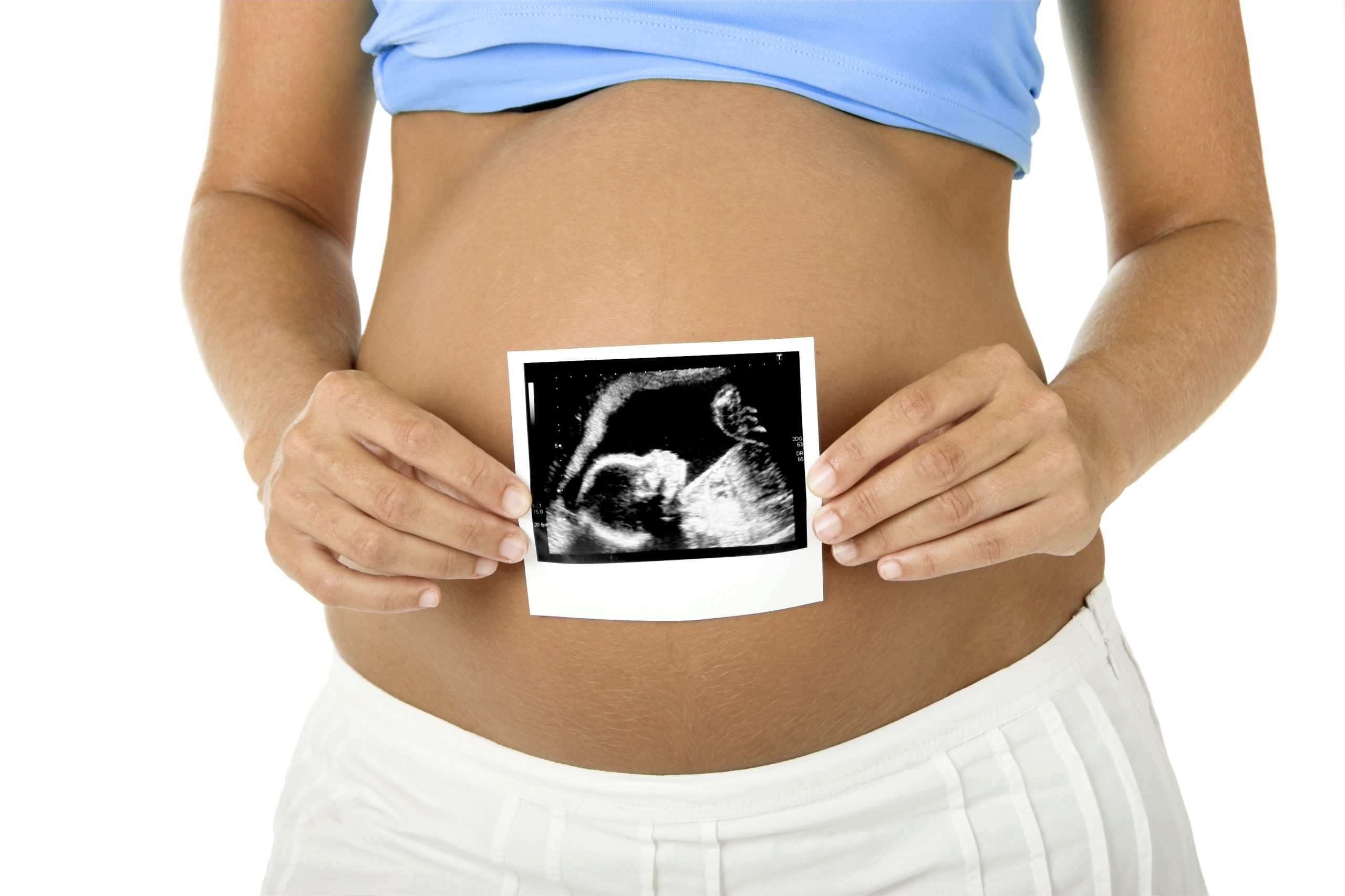 Study Finds Ultrasound In 1st Trimester of Pregnancy Linked To Autism