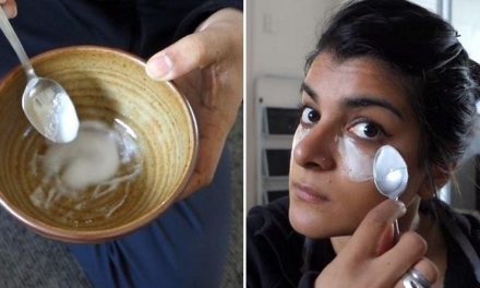 The Stunning Results from Rubbing Baking Soda On Her Cheeks 3 Times A Week!