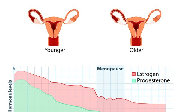 At Menopause: Estrogen-Only Therapy Carries Lower Risk of Blood Clots