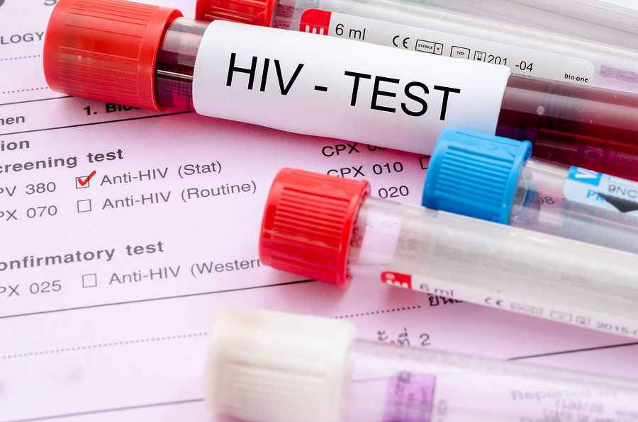 HIV-Prevention Drug Has First Failure