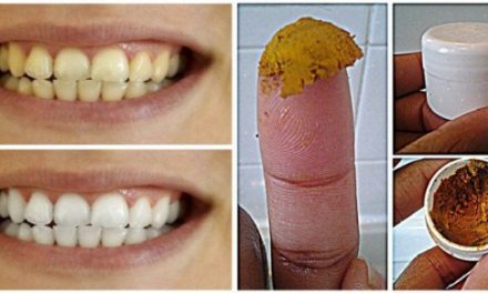 Be Your Own Dentist! Heal Cavities, Gum Disease, AND Whiten Teeth With This Natural Homemade Toothpaste