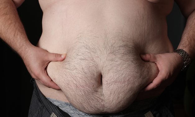 10 Foods That Are Highly Fattening