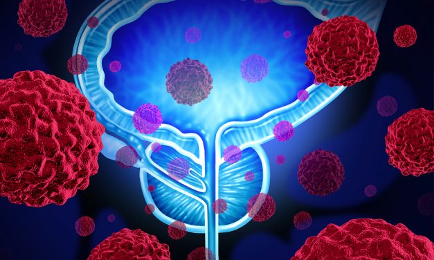 More Men With Early Prostate Cancer Are Choosing to Avoid Treatment