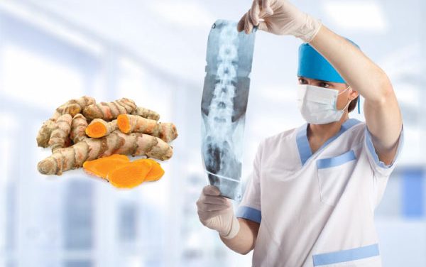 Turmeric Heals Spinal Cord Injuries Better Than Drugs/Surgery, Review Suggests