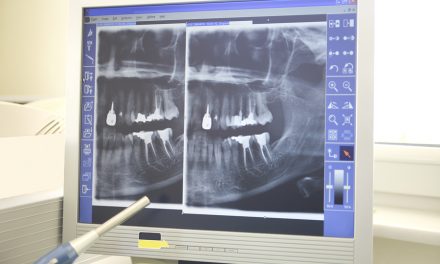 CBS: Stem Cells Could Make Root Canals History