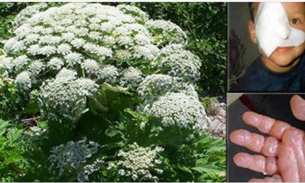 If You See This Plant, Whatever You Do, Do NOT Touch It!