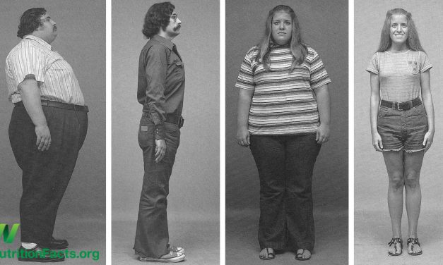 Can Morbid Obesity Be Reversed Through Diet?