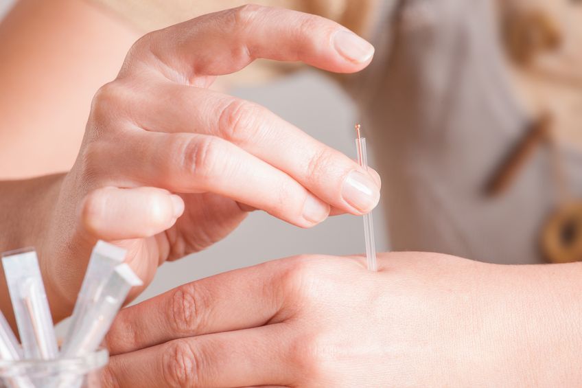 Acupuncture Beats Injected Morphine for Pain: Groundbreaking Study