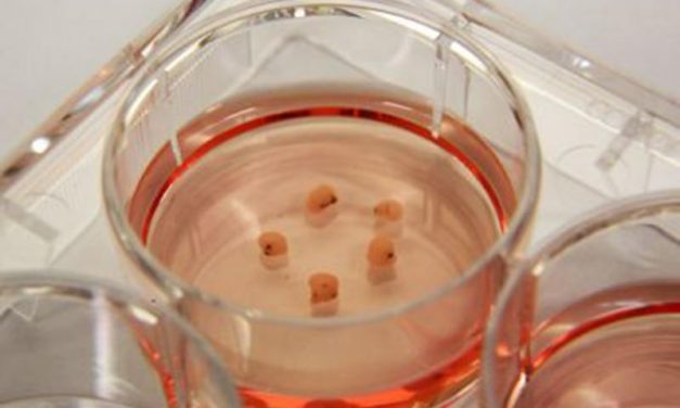 Scientists Grow Mini Brains
