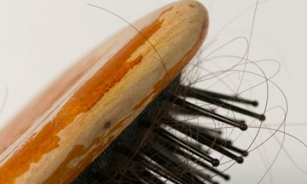 10 things you need to get the moment your hair starts falling out