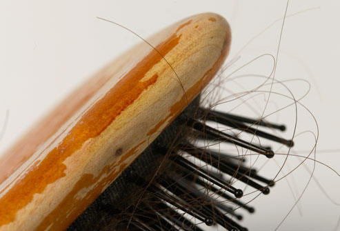 10 things you need to get the moment your hair starts falling out