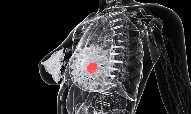 Top Foods 12 Foods That Prevent Breast Cancer