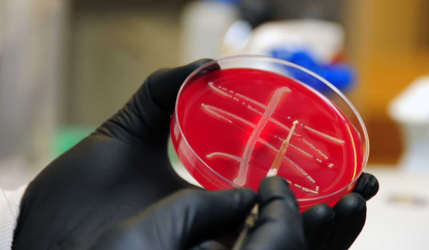 Rare Superbug Gene Discovered on U.S. Pig Farm