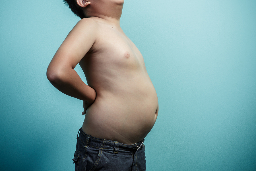 Childhood Obesity is Prematurely Aging our Kids