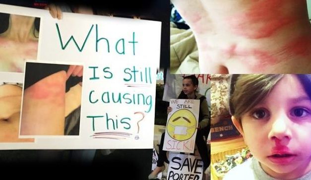 Media Blackout: Mystery Illness Plagues Residents One Year After Historic US Gas Leak