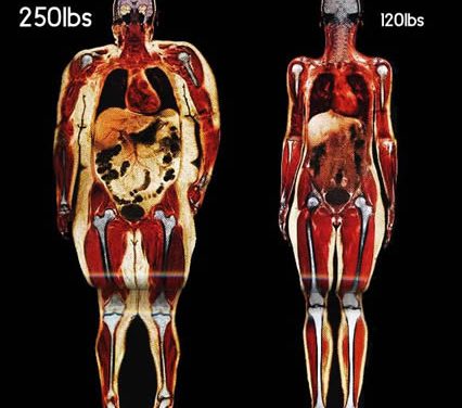 Review of 200 Studies Confirms That Every Pound Gained Increases Risk of Many Cancers