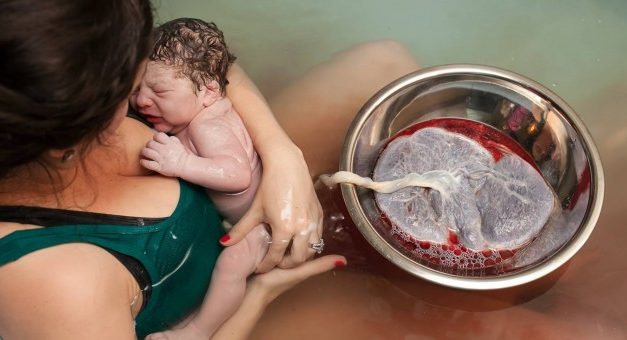 Experts FINALLY Agree with Midwives, Wait to Cut Umbilical Cord