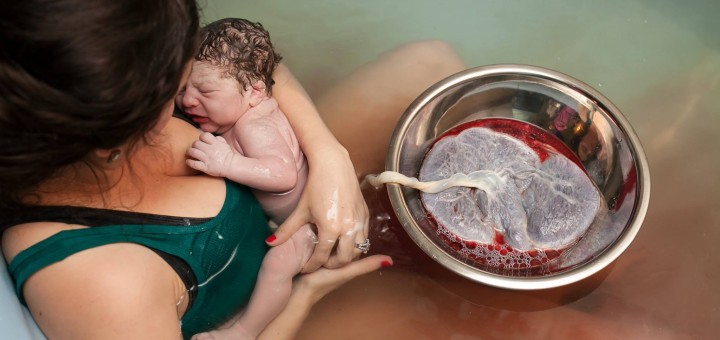 Experts FINALLY Agree with Midwives, Wait to Cut Umbilical Cord