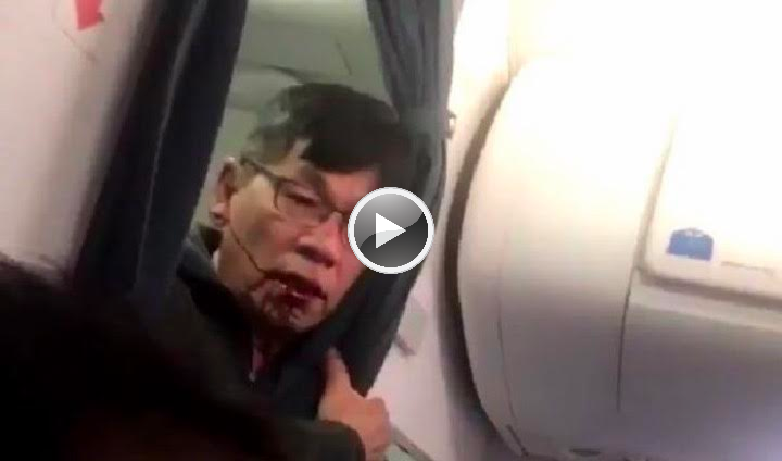 New Video Shows Bloodied Doctor Being Assaulted & Dragged Off Oversold United Airlines Flight