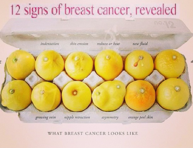 CBS: Study Finds Unbelievable Rise in Mastectomies in Certain States