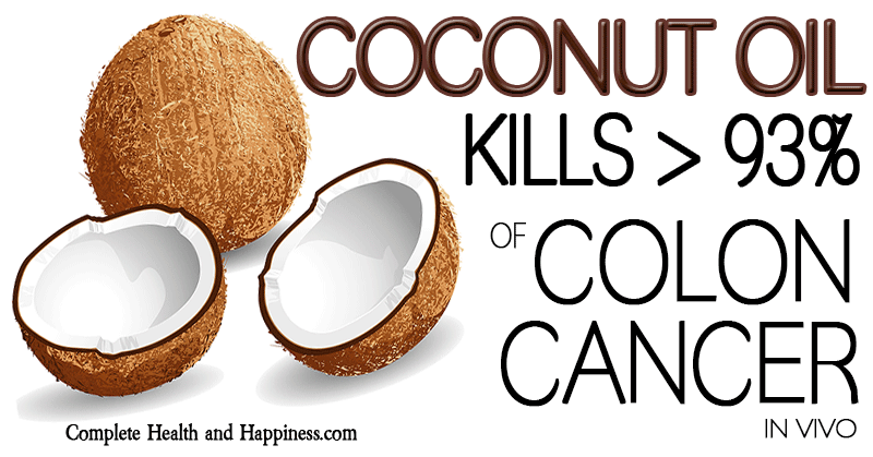 Coconut Oil kills >93% of colon cancer cells in vivo
