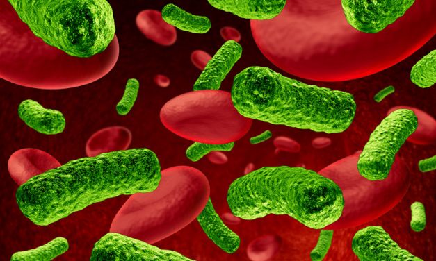 How to survive Sepsis