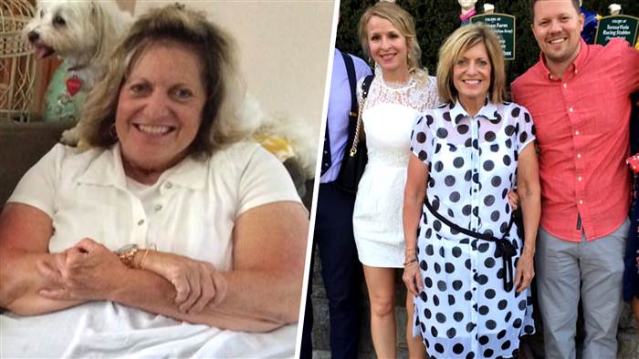 62-Year-Old Mother loses 171 pounds after following these simple, life-changing steps