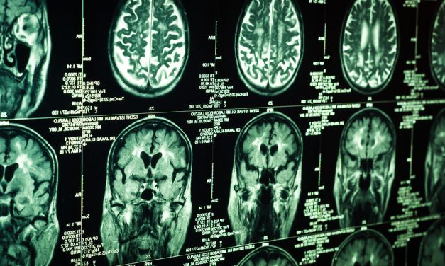 Residents Want Answers After 11 are Diagnosed With Similar Rare Brain Tumors in Same Town