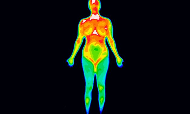 Brown Fat: losing weight through thermogenesis