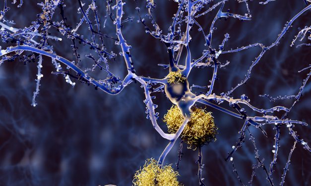 Marijuana compound removes toxic Alzheimer’s protein from the brain