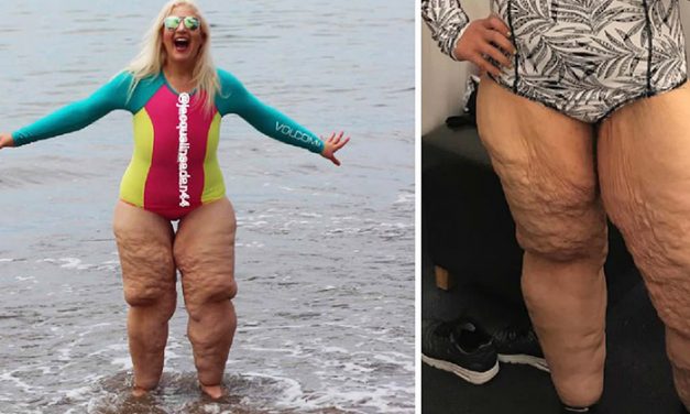 Woman who lost 350 pounds confronts bullies