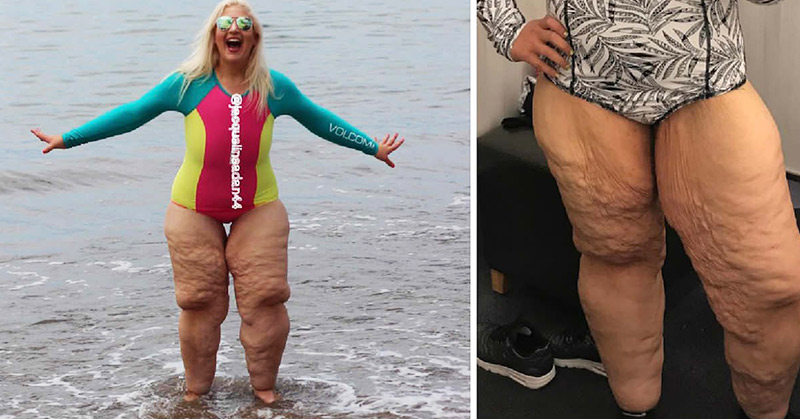 Woman who lost 350 pounds confronts bullies