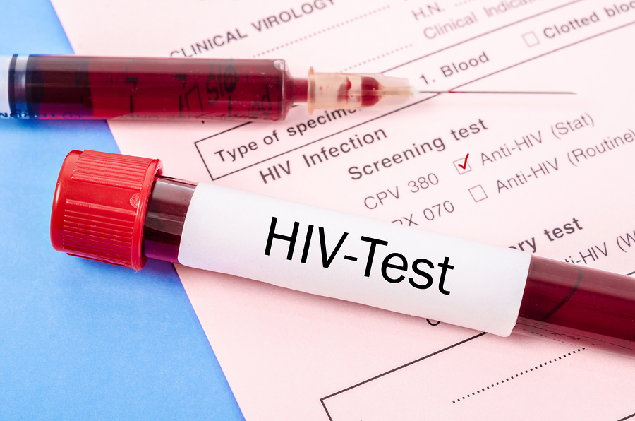 California lowers penalty for knowingly exposing partners to HIV