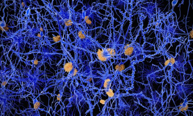 An end to Alzheimer’s? Scientists show how we could block the disease in its earliest stages
