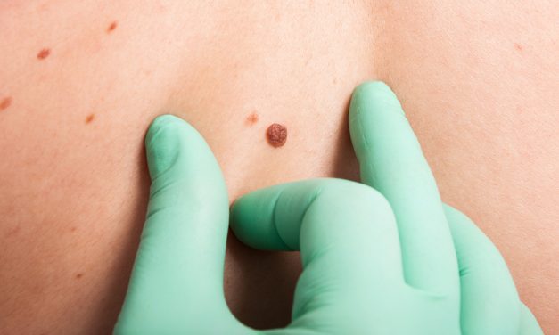 Natural substances that fight malignant melanoma