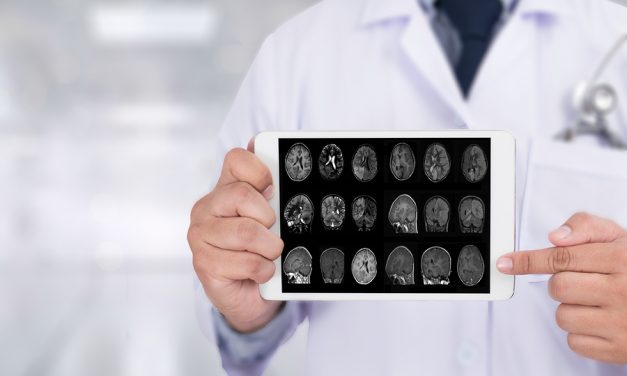 Uncovering the early silent stages of Alzheimer’s Disease