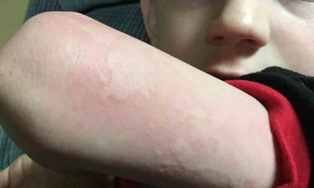 This is the flu symptom you aren’t looking for, but need to know about