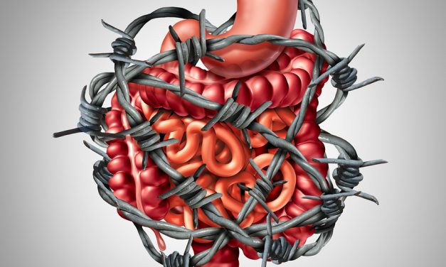 Long-term study links inflammatory diet to colorectal cancer