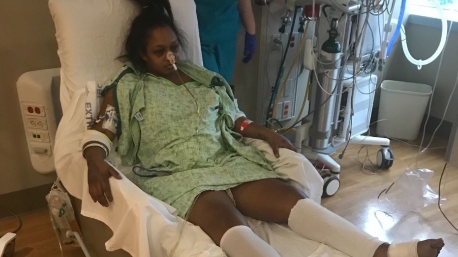 Fox: Mom loses ovaries, uterus and toes after IUD ends up in stomach