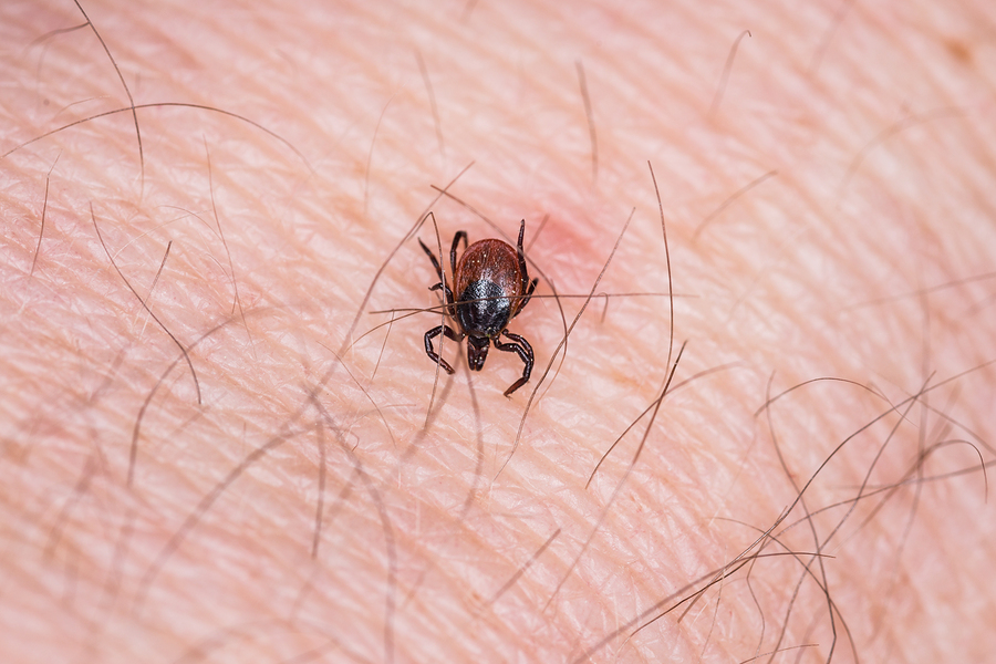 Deadly brain swelling tick virus found in Minnesota and Wisconsin