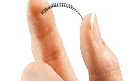 After years of complaints, Bayer forced to stop selling Essure contraceptive coil