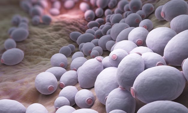 The facts about candida overgrowth and how to overcome it