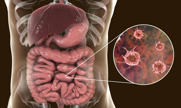CNN: People sickened across 10 states by parasite in outbreak linked to McDonald’s salads