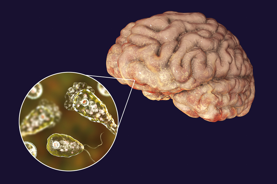 giant microbes brain eating amoeba