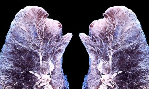 This is what happens with your lungs when you diffuse essential oils