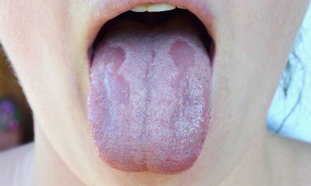 Propolis from honey bees is a powerful superfood that kills Candida albicans