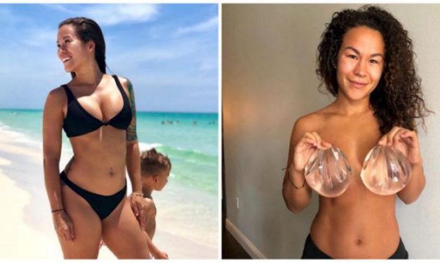 Yahoo: I got my breast implants removed and feel better than I have in years