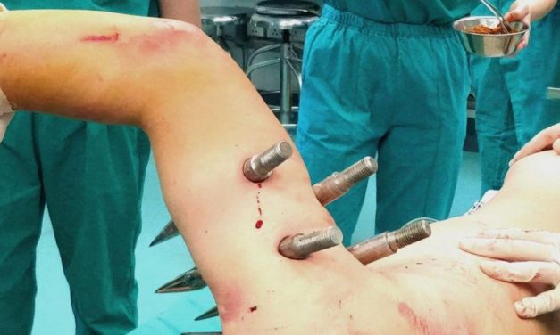 Factory robot impales worker with 10 foot-long steel spikes after horror malfunction